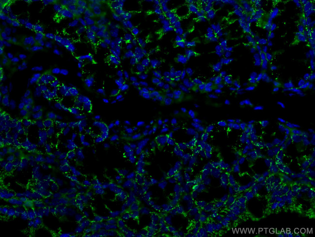 ALDH1A1 Antibody in Immunohistochemistry (PFA fixed) (IHC (PFA))