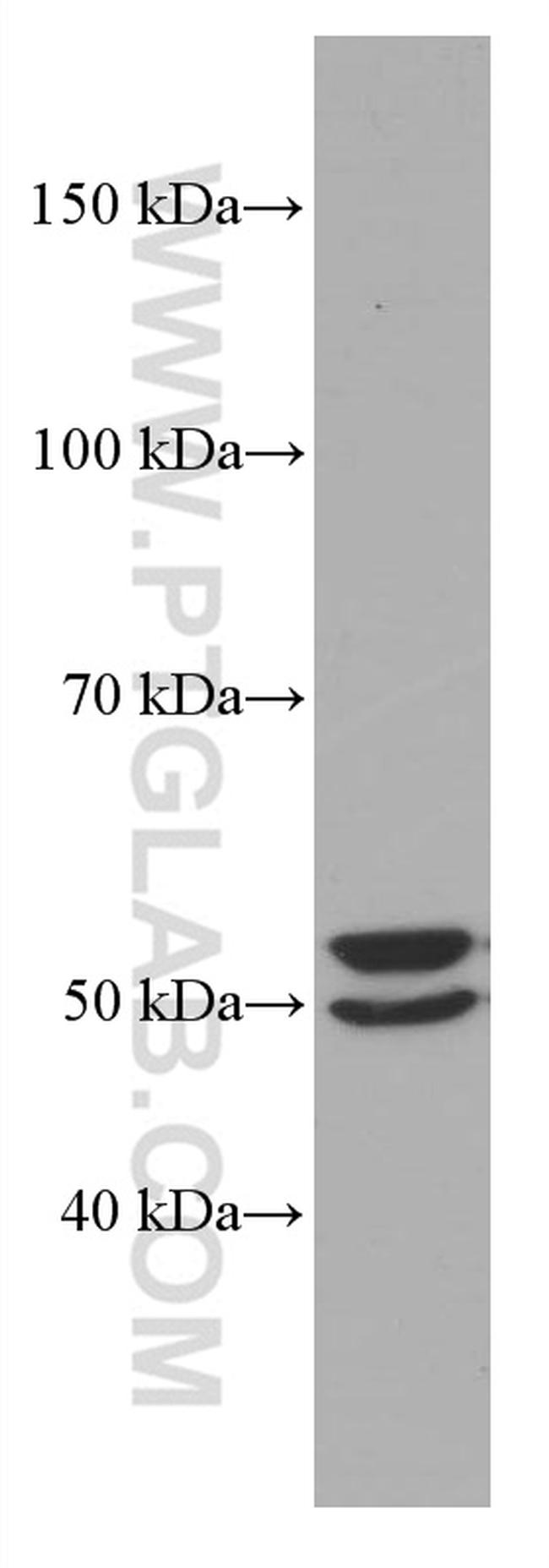 ALDH1A1 Antibody in Western Blot (WB)