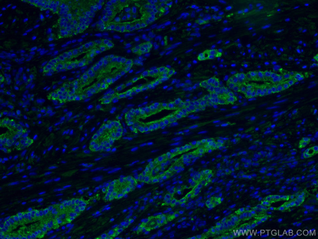 ACPP Antibody in Immunohistochemistry (PFA fixed) (IHC (PFA))