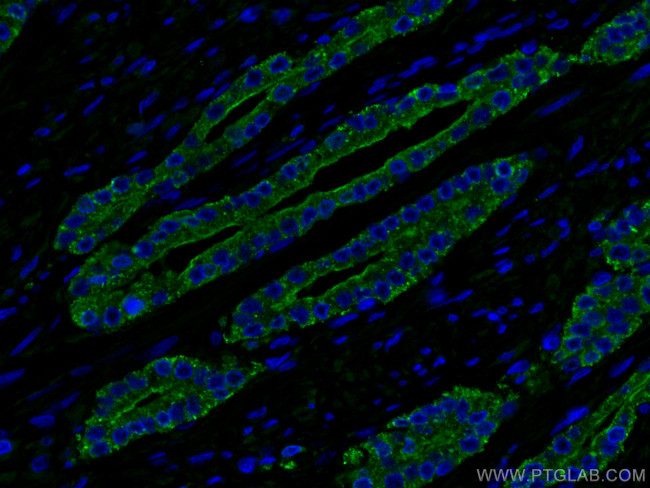 ACPP Antibody in Immunohistochemistry (PFA fixed) (IHC (PFA))