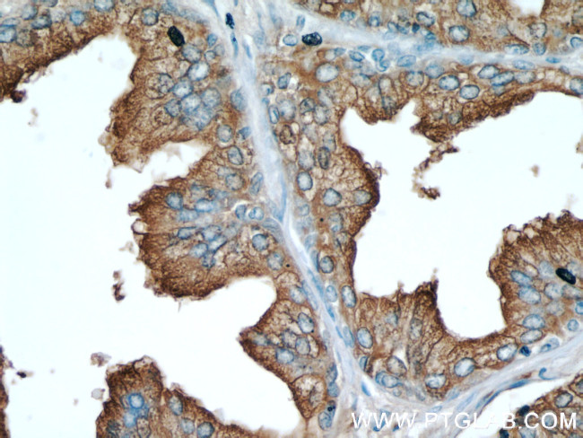 ACPP Antibody in Immunohistochemistry (Paraffin) (IHC (P))