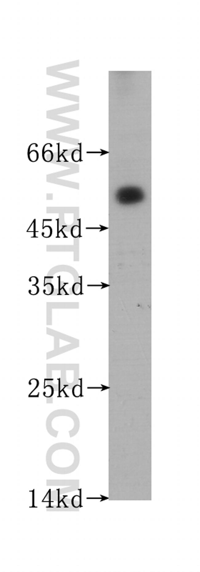 ACPP Antibody in Western Blot (WB)