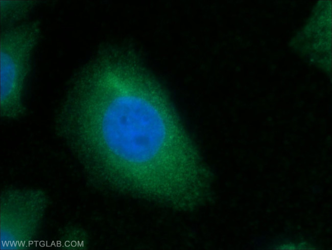 CKM Antibody in Immunocytochemistry (ICC/IF)