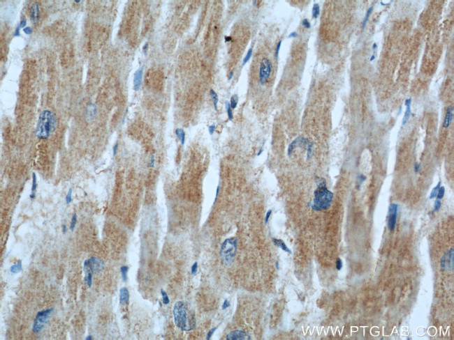 CKM Antibody in Immunohistochemistry (Paraffin) (IHC (P))