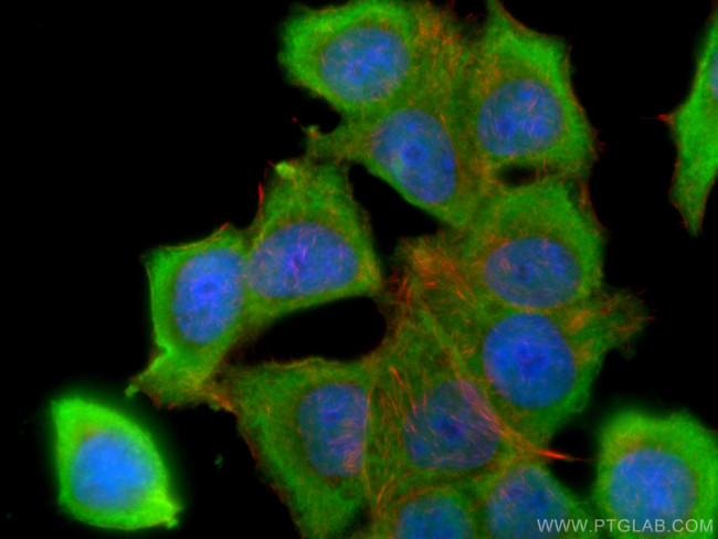 BCL2 Antibody in Immunocytochemistry (ICC/IF)