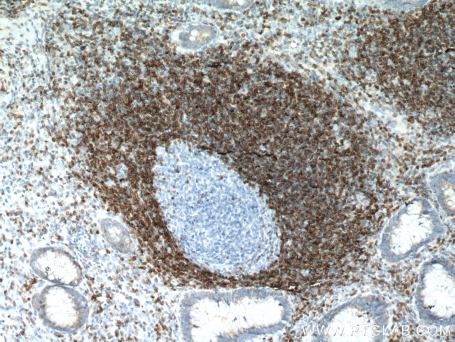 BCL2 Antibody in Immunohistochemistry (Paraffin) (IHC (P))