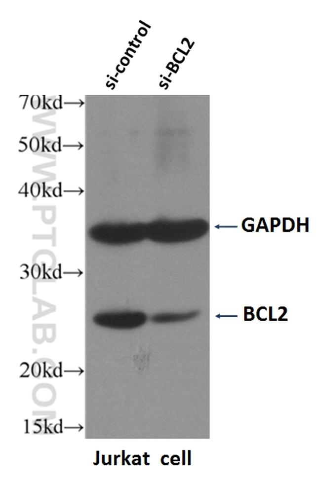 BCL2 Antibody in Western Blot (WB)