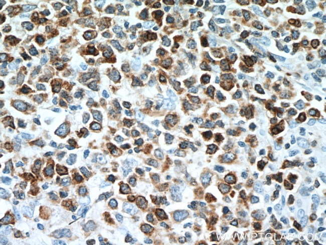 BCL2 Antibody in Immunohistochemistry (Paraffin) (IHC (P))