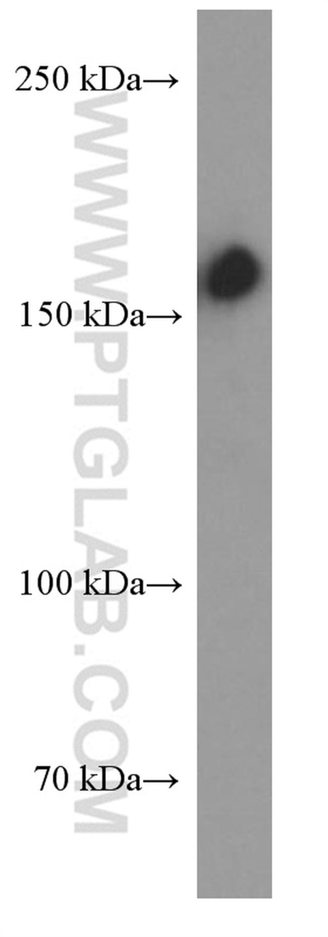 CD109 Antibody in Western Blot (WB)