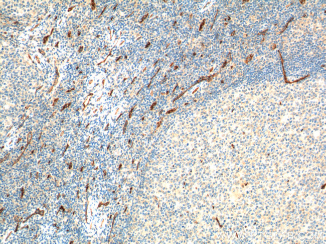 CD34 Antibody in Immunohistochemistry (Paraffin) (IHC (P))