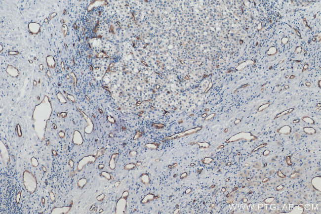 CD34 Antibody in Immunohistochemistry (Paraffin) (IHC (P))