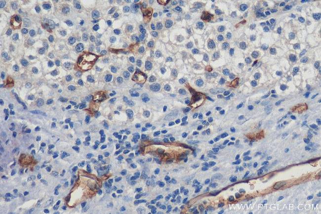 CD34 Antibody in Immunohistochemistry (Paraffin) (IHC (P))