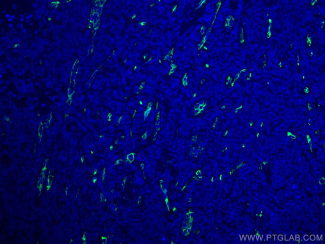 CD34 Antibody in Immunohistochemistry (PFA fixed) (IHC (PFA))