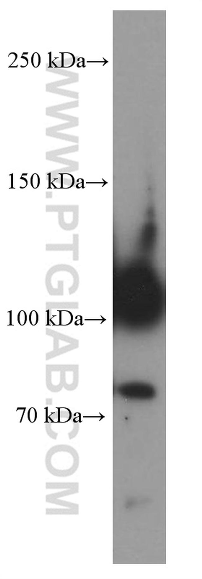 CD34 Antibody in Western Blot (WB)