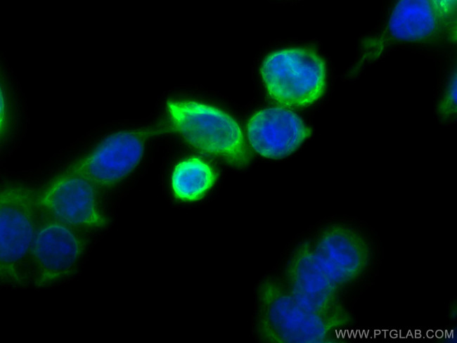 Cytokeratin 20 Antibody in Immunocytochemistry (ICC/IF)