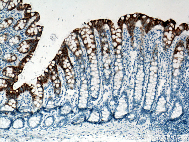 Cytokeratin 20 Antibody in Immunohistochemistry (Paraffin) (IHC (P))