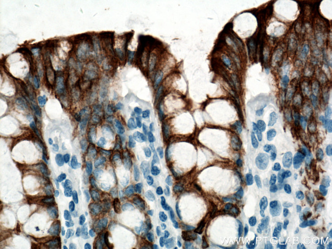 Cytokeratin 20 Antibody in Immunohistochemistry (Paraffin) (IHC (P))