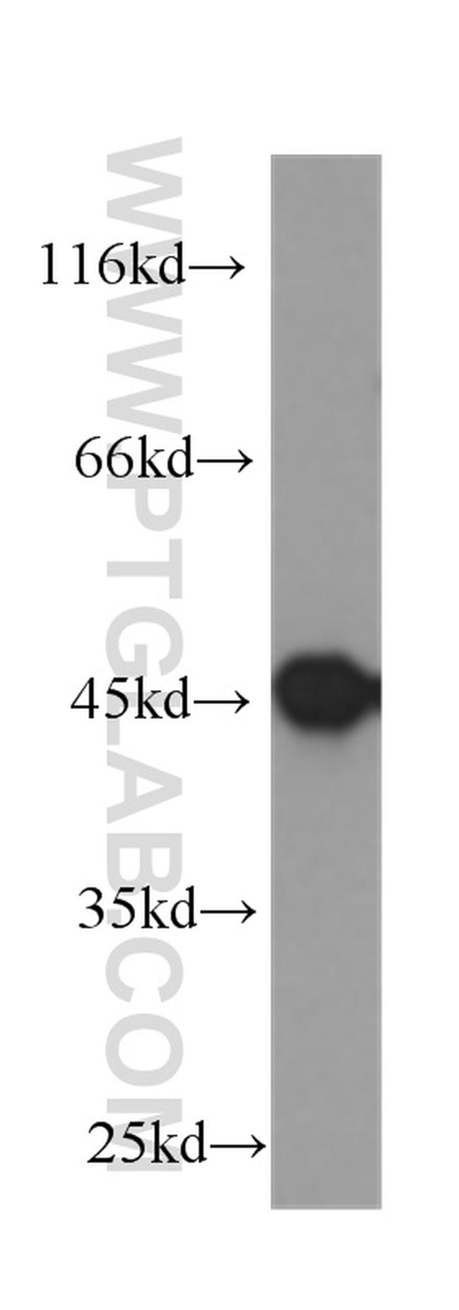 Cytokeratin 20 Antibody in Western Blot (WB)