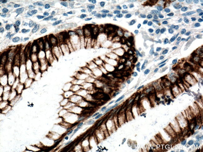 Cytokeratin 20 Antibody in Immunohistochemistry (Paraffin) (IHC (P))