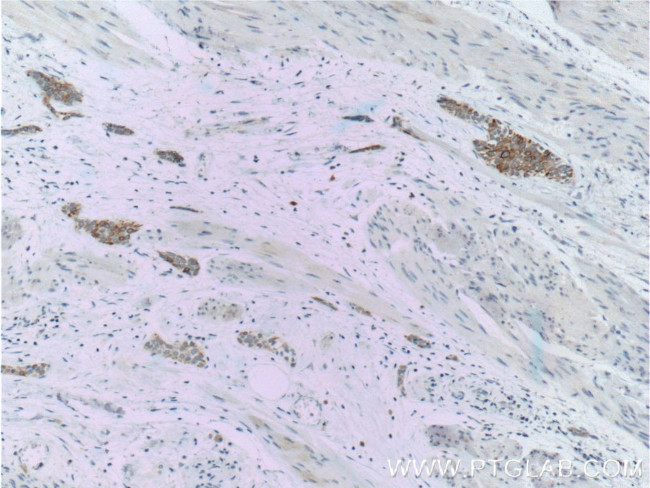 Cytokeratin 20 Antibody in Immunohistochemistry (Paraffin) (IHC (P))