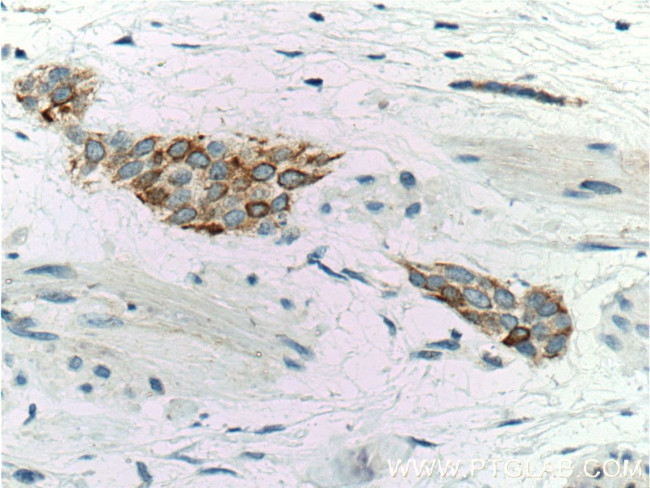 Cytokeratin 20 Antibody in Immunohistochemistry (Paraffin) (IHC (P))