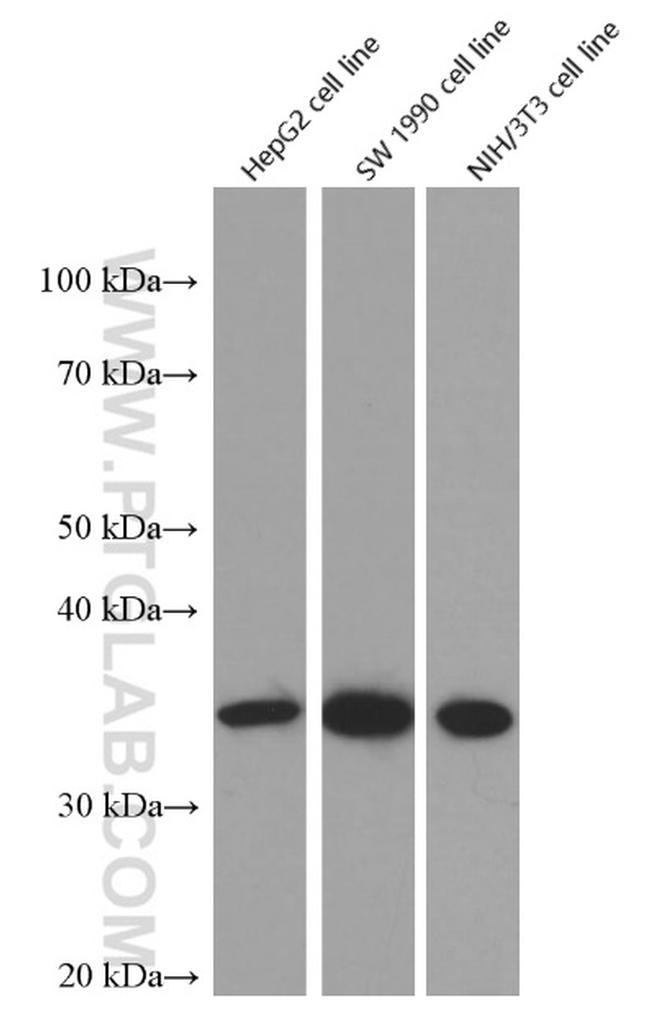 Cyclin D1 Antibody in Western Blot (WB)