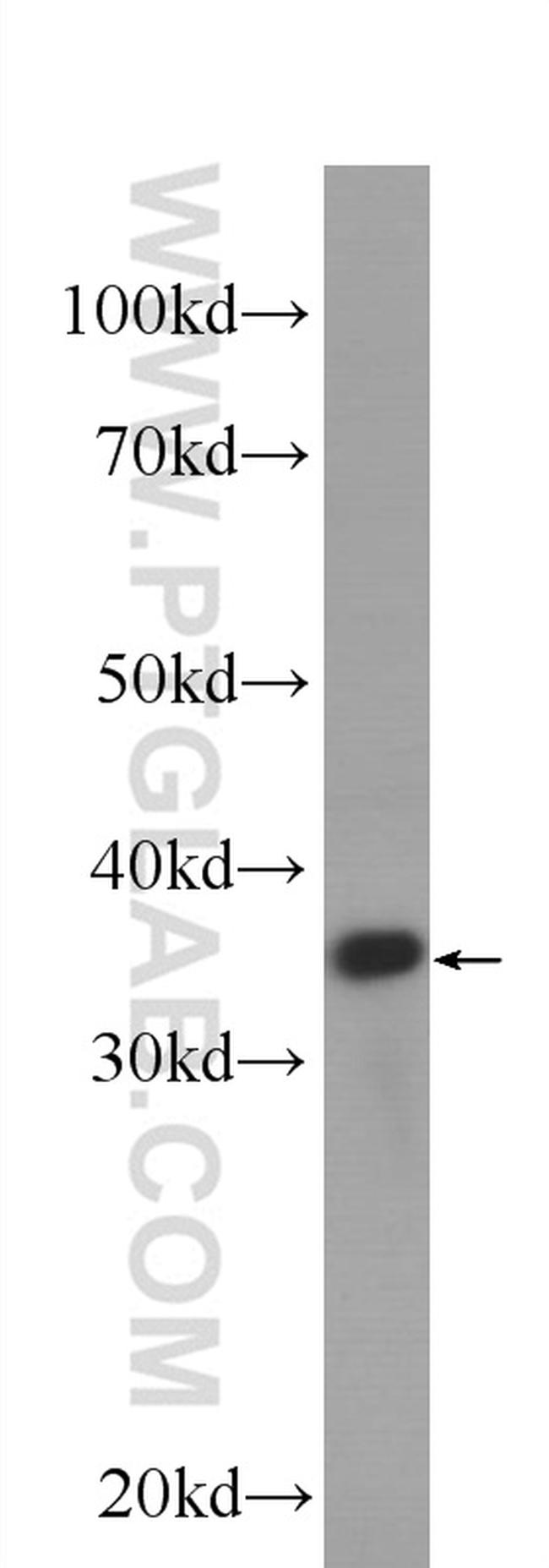 Cyclin D1 Antibody in Western Blot (WB)