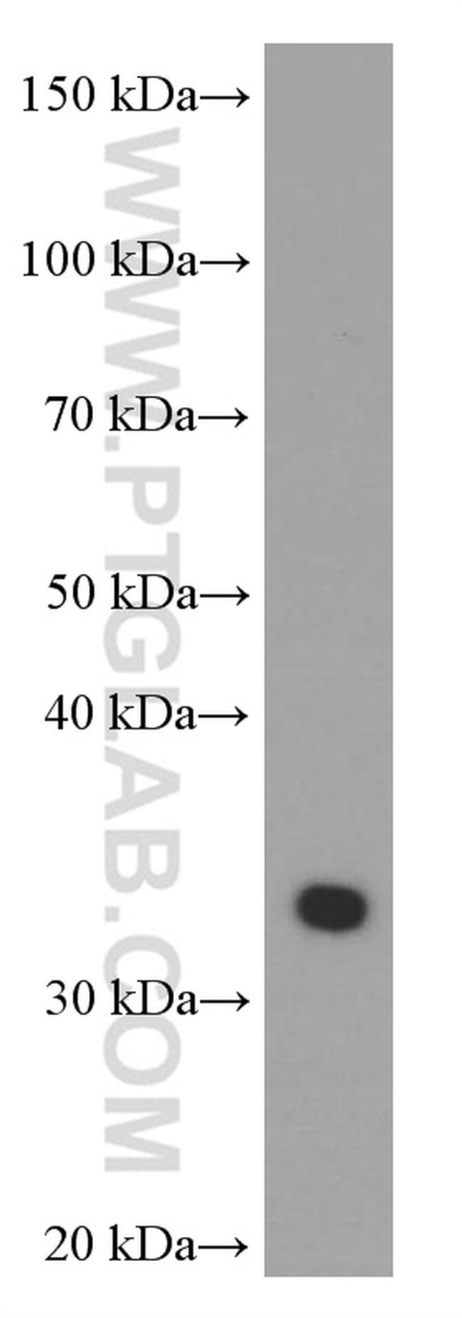 Cyclin D1 Antibody in Western Blot (WB)