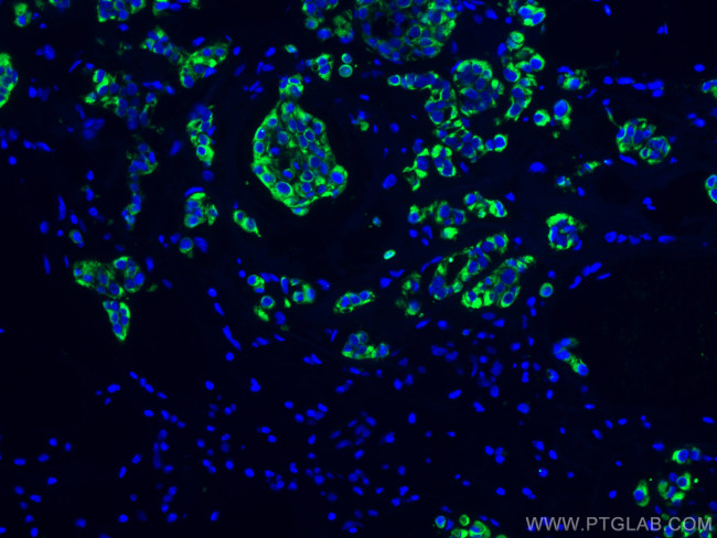 Cytokeratin 19 Antibody in Immunohistochemistry (PFA fixed) (IHC (PFA))