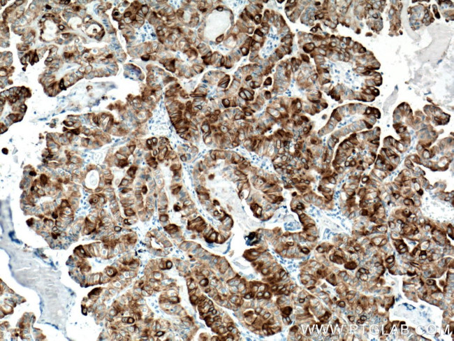 Cytokeratin 19 Antibody in Immunohistochemistry (Paraffin) (IHC (P))