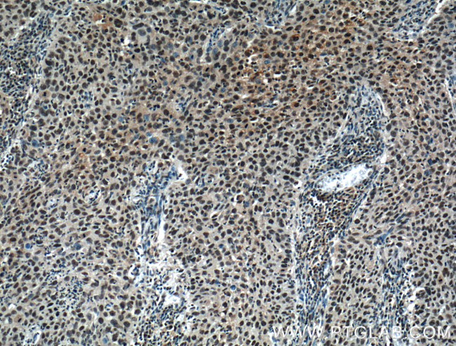 WTAP Antibody in Immunohistochemistry (Paraffin) (IHC (P))