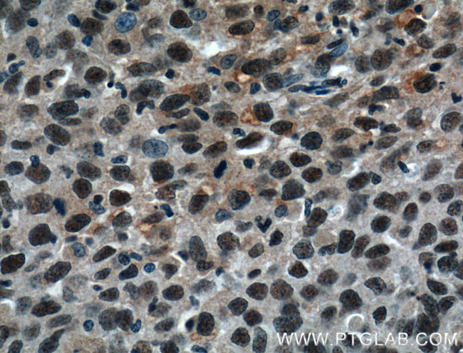 WTAP Antibody in Immunohistochemistry (Paraffin) (IHC (P))