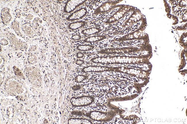 WTAP Antibody in Immunohistochemistry (Paraffin) (IHC (P))