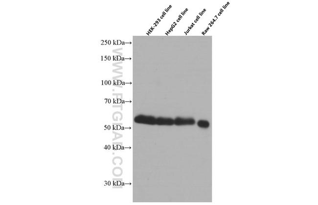 WTAP Antibody in Western Blot (WB)