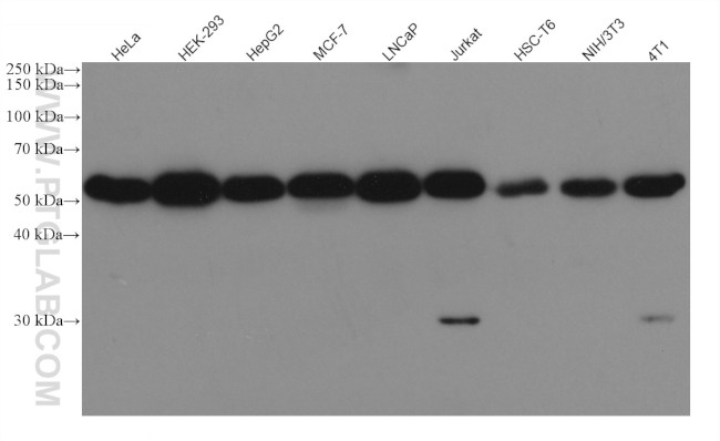 WTAP Antibody in Western Blot (WB)