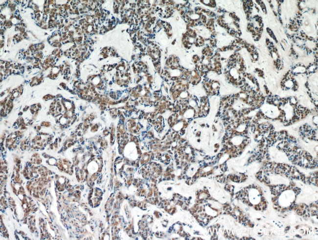 WTAP Antibody in Immunohistochemistry (Paraffin) (IHC (P))