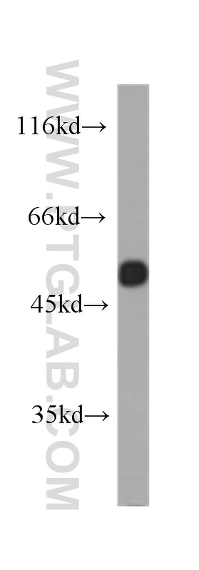 WTAP Antibody in Western Blot (WB)