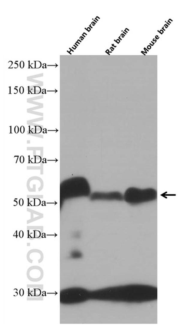 WTAP Antibody in Western Blot (WB)