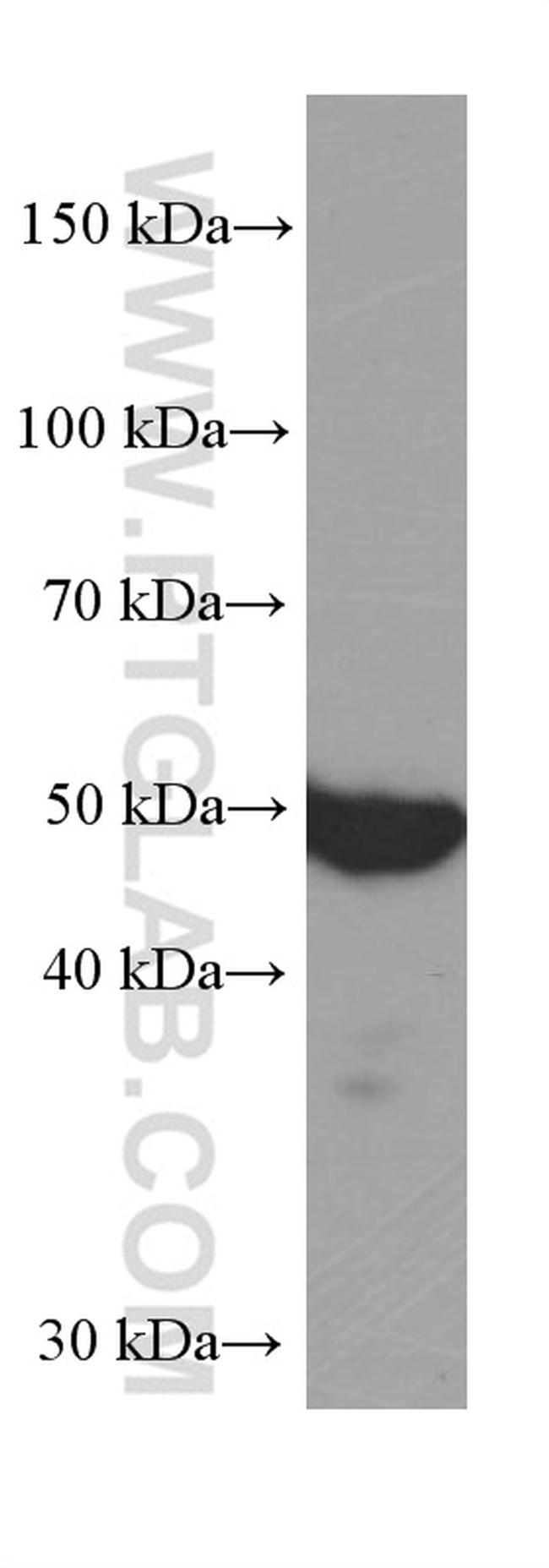 WTAP Antibody in Western Blot (WB)