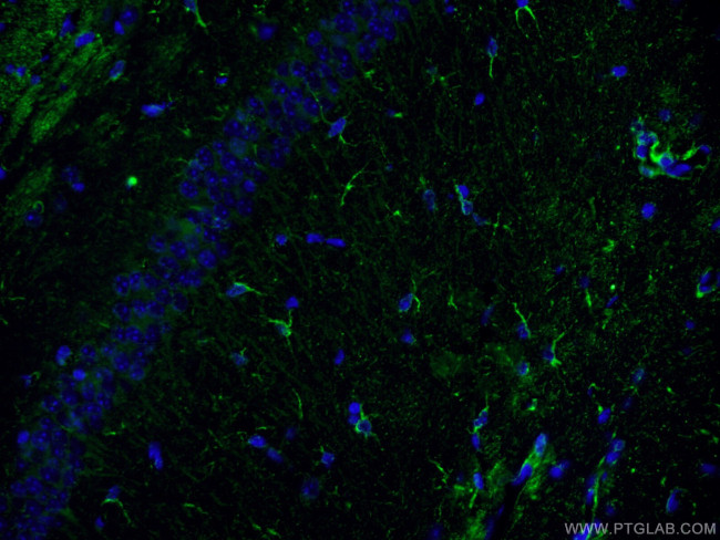 NF-L Antibody in Immunohistochemistry (PFA fixed) (IHC (PFA))