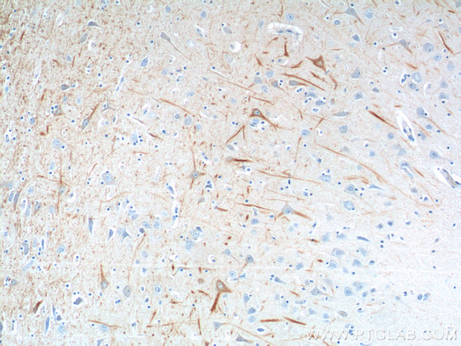 NF-L Antibody in Immunohistochemistry (Paraffin) (IHC (P))