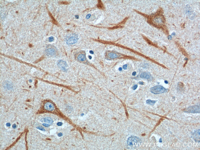 NF-L Antibody in Immunohistochemistry (Paraffin) (IHC (P))