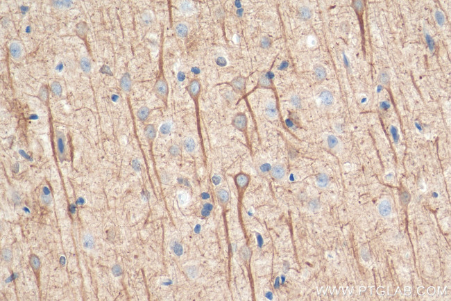 NF-L Antibody in Immunohistochemistry (Paraffin) (IHC (P))