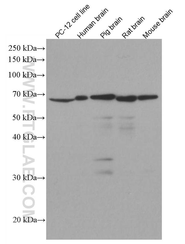 NF-L Antibody in Western Blot (WB)