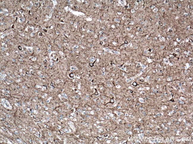 NF-L Antibody in Immunohistochemistry (Paraffin) (IHC (P))