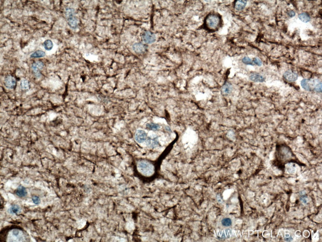 NF-L Antibody in Immunohistochemistry (Paraffin) (IHC (P))