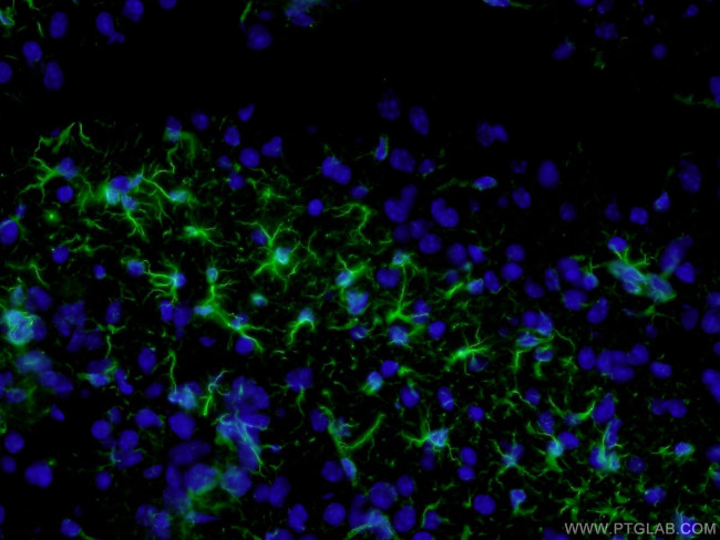 GFAP Antibody in Immunohistochemistry (PFA fixed) (IHC (PFA))