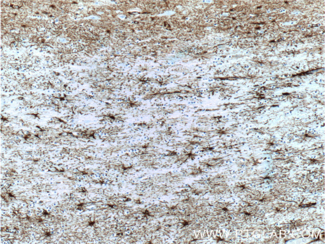 GFAP Antibody in Immunohistochemistry (Paraffin) (IHC (P))