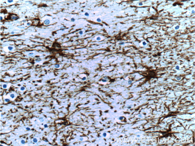 GFAP Antibody in Immunohistochemistry (Paraffin) (IHC (P))