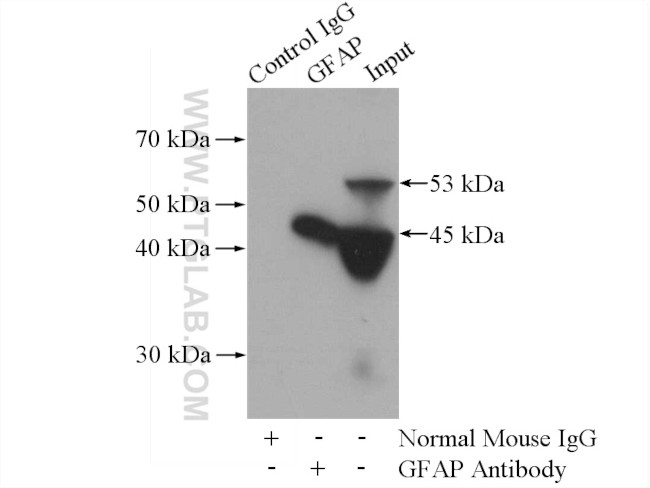 GFAP Antibody in Immunoprecipitation (IP)